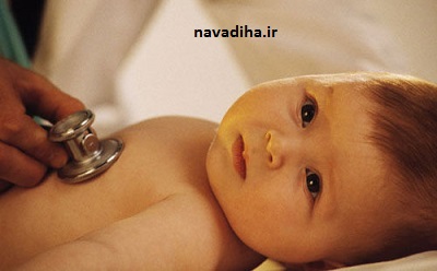 اطلاعاتی درباره زردی در نوزادان